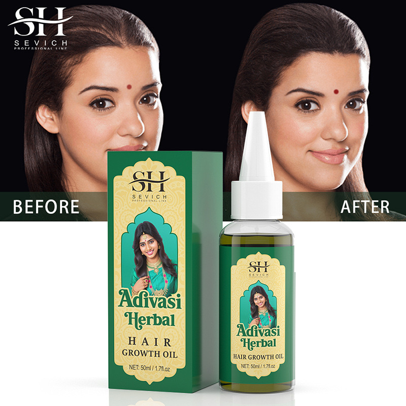 Ayurvedic & Herbal Wellness Kits - Aceite indio Original de 50ml, aceite