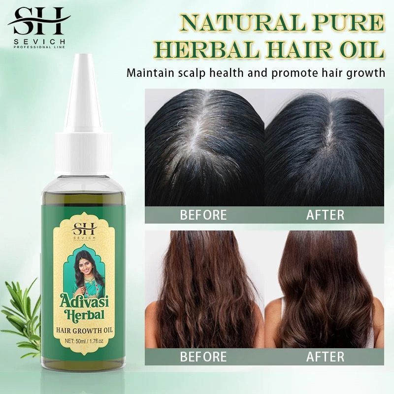Aceite Ayurvédico para el Crec - Ayurvedic & Herbal Wellness Kits reseña y precio